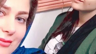 صورة نورا مع سيدة ملكية لعملية تجميل الأنف وشد البطن في إيران، تظهر استشارة جمالية ناجحة مع أفضل ليدر تجميل في مشهد.