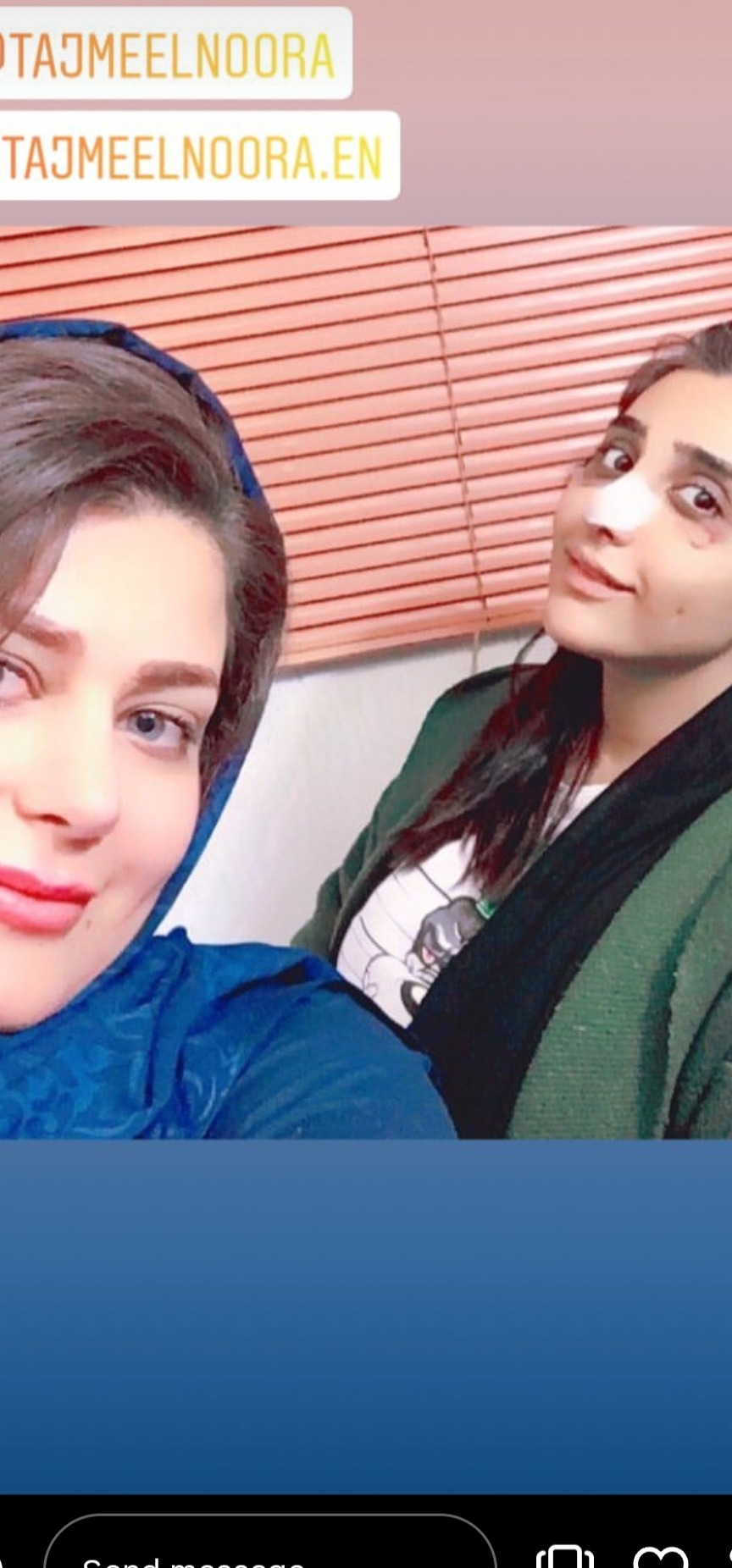 صورة نورا مع سيدة ملكية لعملية تجميل الأنف وشد البطن في إيران، تظهر استشارة جمالية ناجحة مع أفضل ليدر تجميل في مشهد.
